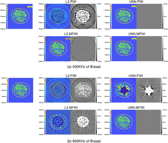 Figure 4 for A Plug-and-Play Untrained Neural Network for Full Waveform Inversion in Reconstructing Sound Speed Images of Ultrasound Computed Tomography