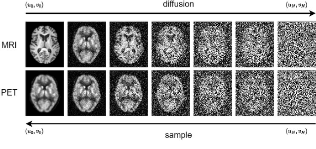 Figure 1 for Joint PET-MRI Reconstruction with Diffusion Stochastic Differential Model