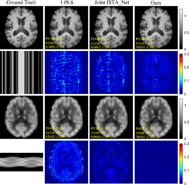 Figure 2 for Joint PET-MRI Reconstruction with Diffusion Stochastic Differential Model