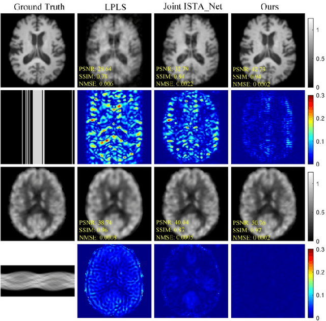 Figure 3 for Joint PET-MRI Reconstruction with Diffusion Stochastic Differential Model