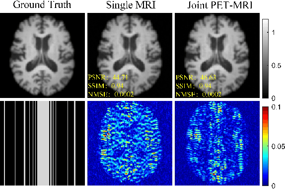 Figure 4 for Joint PET-MRI Reconstruction with Diffusion Stochastic Differential Model