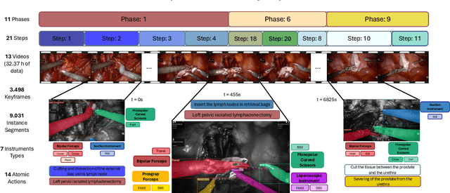 Figure 1 for Pixel-Wise Recognition for Holistic Surgical Scene Understanding