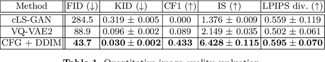 Figure 2 for Synthesising Rare Cataract Surgery Samples with Guided Diffusion Models