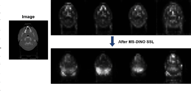 Figure 4 for MS-DINO: Efficient Distributed Training of Vision Transformer Foundation Model in Medical Domain through Masked Sampling