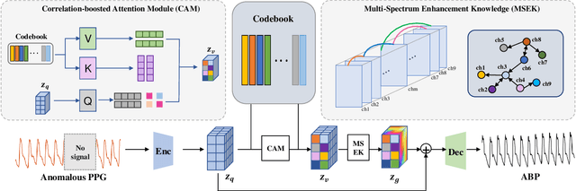 Figure 3 for Constraint Latent Space Matters: An Anti-anomalous Waveform Transformation Solution from Photoplethysmography to Arterial Blood Pressure