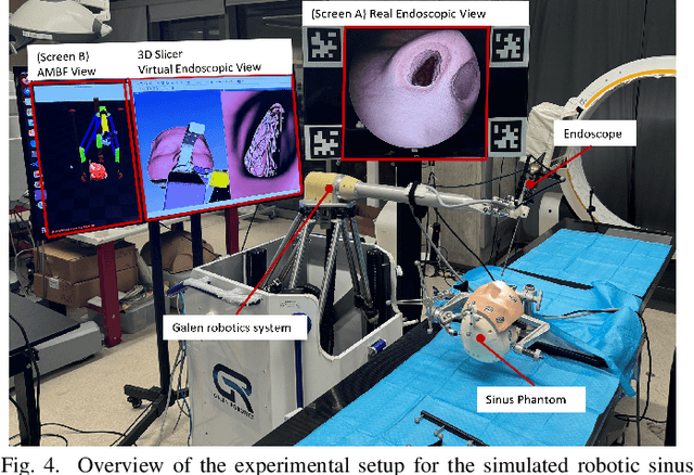 Figure 4 for Integrating 3D Slicer with a Dynamic Simulator for Situational Aware Robotic Interventions