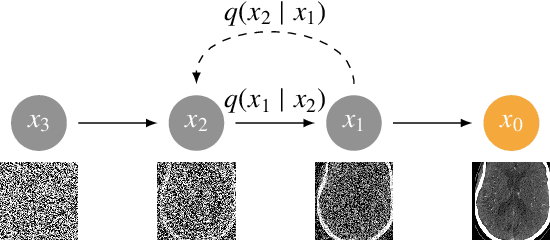 Figure 1 for Cross-modality image synthesis from TOF-MRA to CTA using diffusion-based models