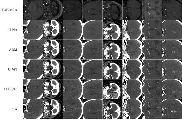 Figure 3 for Cross-modality image synthesis from TOF-MRA to CTA using diffusion-based models