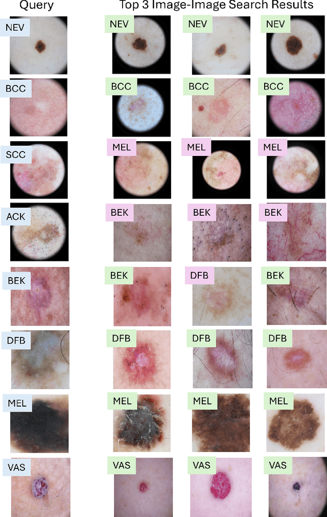 Figure 4 for MedImageInsight: An Open-Source Embedding Model for General Domain Medical Imaging