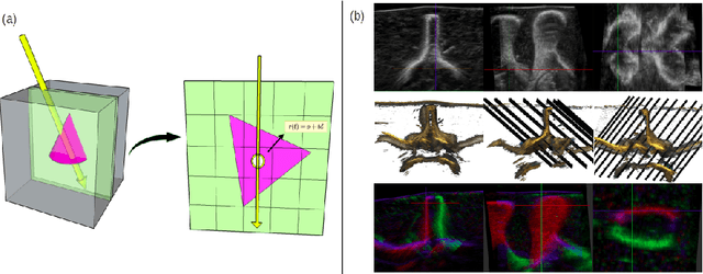 Figure 3 for Ultra-NeRF: Neural Radiance Fields for Ultrasound Imaging