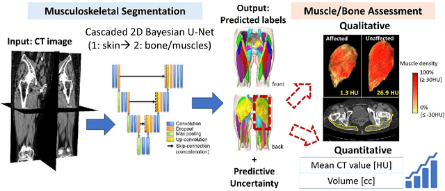 Figure 3 for Validation of musculoskeletal segmentation model with uncertainty estimation for bone and muscle assessment in hip-to-knee clinical CT images