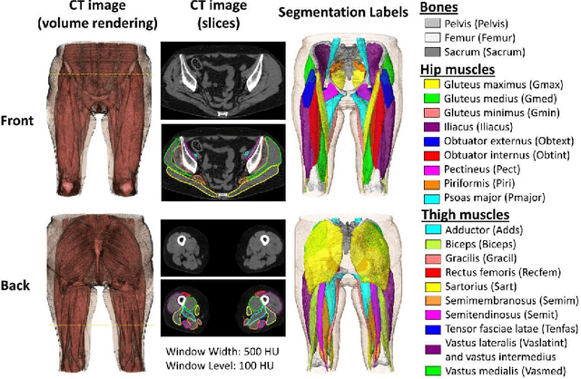 Figure 4 for Validation of musculoskeletal segmentation model with uncertainty estimation for bone and muscle assessment in hip-to-knee clinical CT images