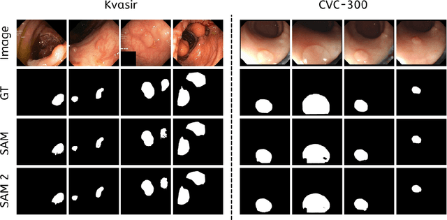 Figure 2 for Polyp SAM 2: Advancing Zero shot Polyp Segmentation in Colorectal Cancer Detection