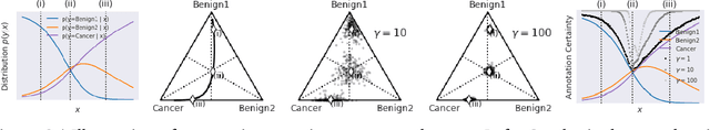 Figure 2 for Evaluating AI systems under uncertain ground truth: a case study in dermatology