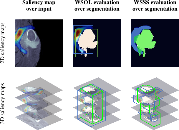 Figure 1 for SE3D: A Framework For Saliency Method Evaluation In 3D Imaging