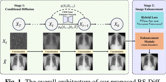 Figure 1 for BS-Diff: Effective Bone Suppression Using Conditional Diffusion Models from Chest X-Ray Images