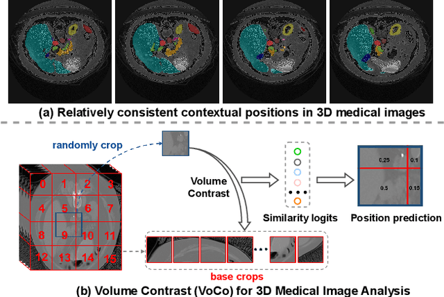 Figure 1 for VoCo: A Simple-yet-Effective Volume Contrastive Learning Framework for 3D Medical Image Analysis