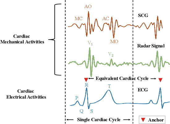 Figure 1 for radarODE-MTL: A Multi-Task Learning Framework with Eccentric Gradient Alignment for Robust Radar-Based ECG Reconstruction