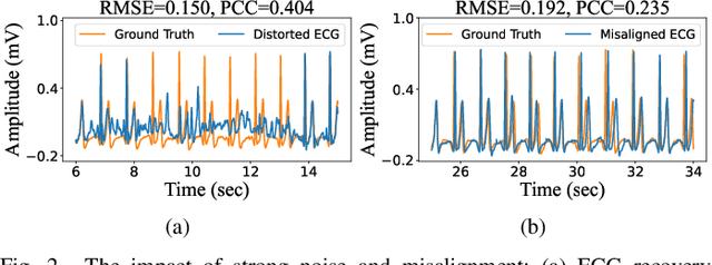 Figure 2 for radarODE-MTL: A Multi-Task Learning Framework with Eccentric Gradient Alignment for Robust Radar-Based ECG Reconstruction