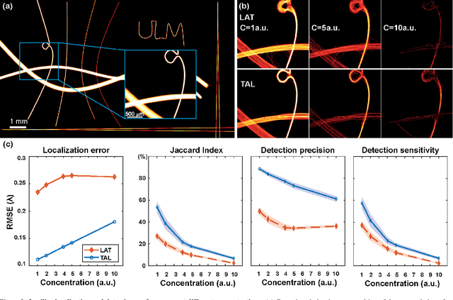 Figure 3 for A Tracking prior to Localization workflow for Ultrasound Localization Microscopy