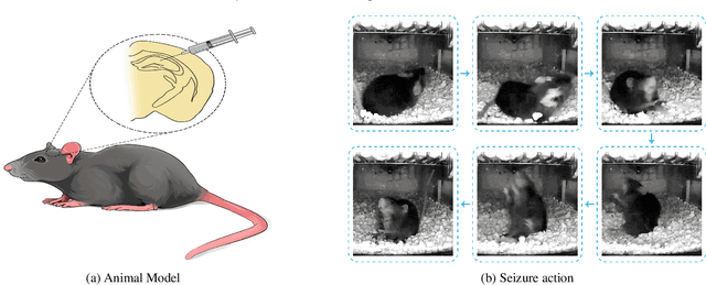 Figure 1 for EPIDetect: Video-based convulsive seizure detection in chronic epilepsy mouse model for anti-epilepsy drug screening