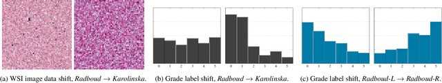 Figure 4 for Evaluating Computational Pathology Foundation Models for Prostate Cancer Grading under Distribution Shifts