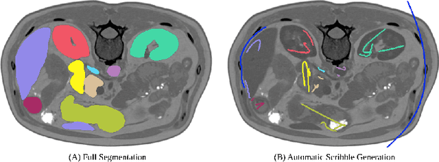 Figure 3 for Embarrassingly Simple Scribble Supervision for 3D Medical Segmentation