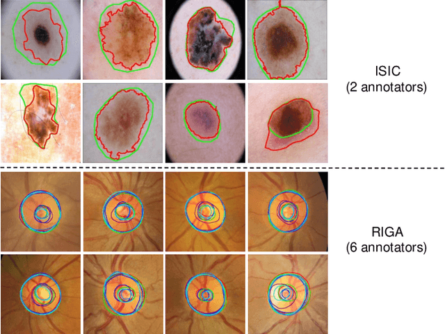 Figure 3 for MSE-Nets: Multi-annotated Semi-supervised Ensemble Networks for Improving Segmentation of Medical Image with Ambiguous Boundaries