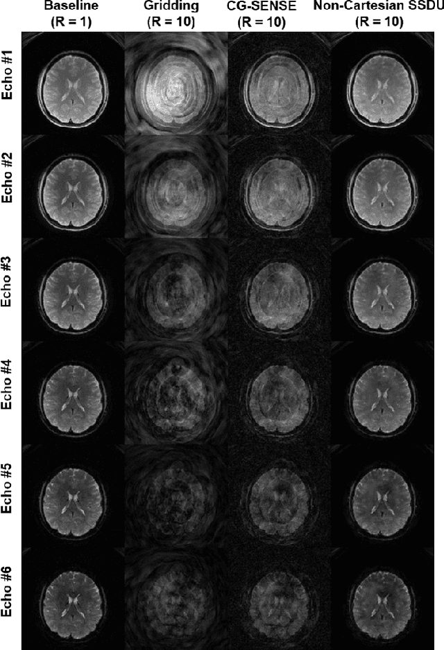 Figure 2 for Non-Cartesian Self-Supervised Physics-Driven Deep Learning Reconstruction for Highly-Accelerated Multi-Echo Spiral fMRI