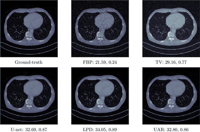 Figure 4 for Unsupervised approaches based on optimal transport and convex analysis for inverse problems in imaging