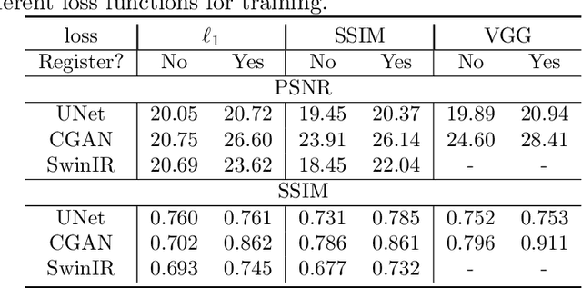 Figure 4 for BVI-Lowlight: Fully Registered Benchmark Dataset for Low-Light Video Enhancement