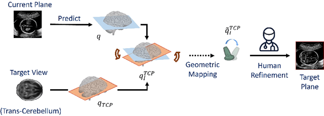 Figure 1 for Pose-GuideNet: Automatic Scanning Guidance for Fetal Head Ultrasound from Pose Estimation