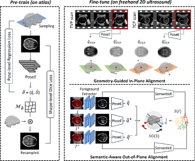 Figure 3 for Pose-GuideNet: Automatic Scanning Guidance for Fetal Head Ultrasound from Pose Estimation