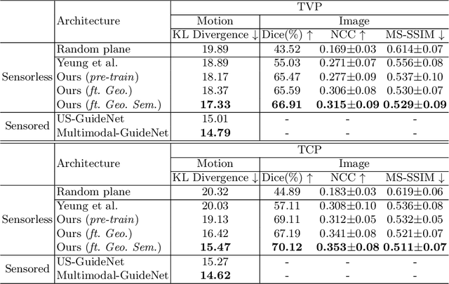 Figure 2 for Pose-GuideNet: Automatic Scanning Guidance for Fetal Head Ultrasound from Pose Estimation