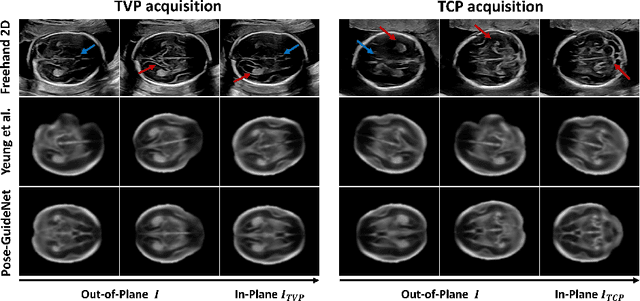 Figure 4 for Pose-GuideNet: Automatic Scanning Guidance for Fetal Head Ultrasound from Pose Estimation