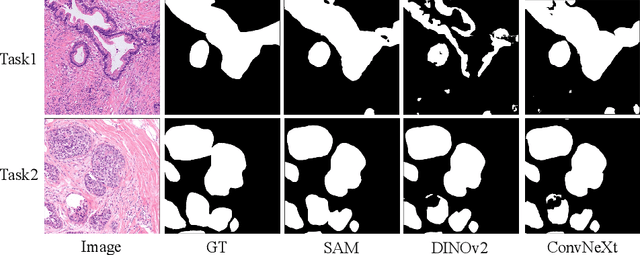 Figure 4 for Cross-Organ and Cross-Scanner Adenocarcinoma Segmentation using Rein to Fine-tune Vision Foundation Models