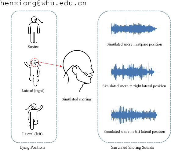 Figure 1 for SimuSOE: A Simulated Snoring Dataset for Obstructive Sleep Apnea-Hypopnea Syndrome Evaluation during Wakefulness