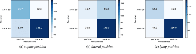 Figure 4 for SimuSOE: A Simulated Snoring Dataset for Obstructive Sleep Apnea-Hypopnea Syndrome Evaluation during Wakefulness