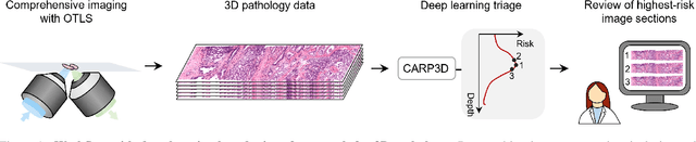 Figure 1 for Triage of 3D pathology data via 2.5D multiple-instance learning to guide pathologist assessments