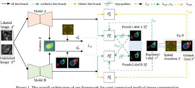 Figure 1 for Learning Semi-Supervised Medical Image Segmentation from Spatial Registration