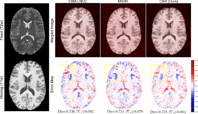 Figure 3 for CAR: Contrast-Agnostic Deformable Medical Image Registration with Contrast-Invariant Latent Regularization