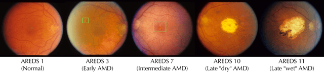 Figure 2 for Harnessing the power of longitudinal medical imaging for eye disease prognosis using Transformer-based sequence modeling