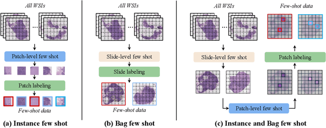 Figure 1 for FAST: A Dual-tier Few-Shot Learning Paradigm for Whole Slide Image Classification