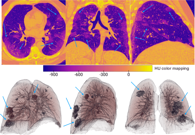 Figure 1 for COVID-VR: A Deep Learning COVID-19 Classification Model Using Volume-Rendered Computer Tomography