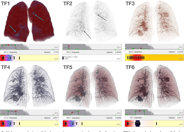 Figure 3 for COVID-VR: A Deep Learning COVID-19 Classification Model Using Volume-Rendered Computer Tomography