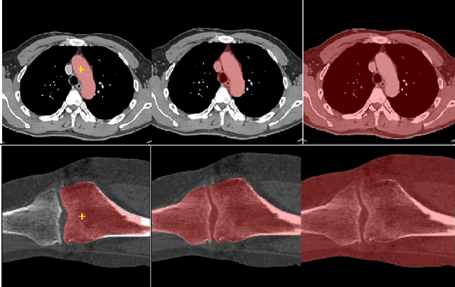 Figure 1 for SAM Fewshot Finetuning for Anatomical Segmentation in Medical Images