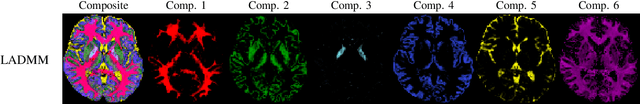 Figure 3 for An Efficient Algorithm for Spatial-Spectral Partial Volume Compartment Mapping with Applications to Multicomponent Diffusion and Relaxation MRI