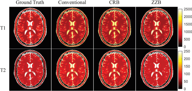 Figure 2 for Optimized Magnetic Resonance Fingerprinting Using Ziv-Zakai Bound