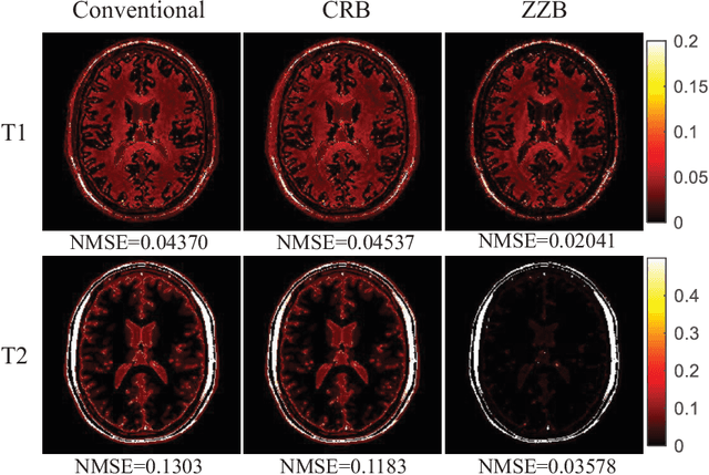 Figure 3 for Optimized Magnetic Resonance Fingerprinting Using Ziv-Zakai Bound