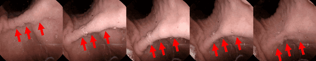 Figure 1 for Detecting and measuring human gastric peristalsis using magnetically controlled capsule endoscope